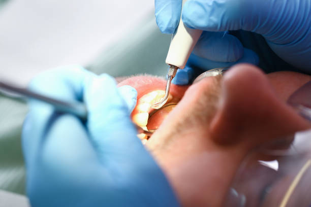 Best Emergency Denture Repair in Cedar Ridge, CA
