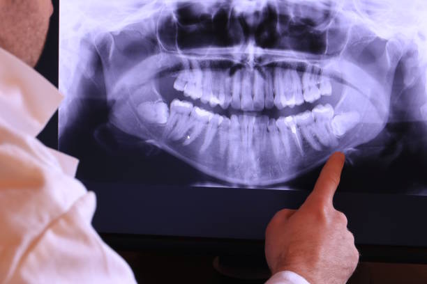 Best Weekend Emergency Dentist in Cedar Ridge, CA