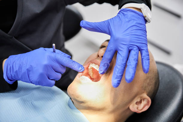 Best Emergency Tooth Extraction in Cedar Ridge, CA