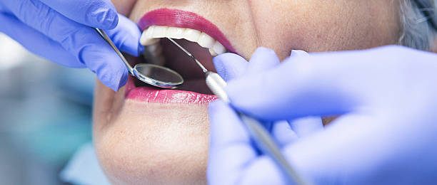Best Emergency TMJ Treatment in Cedar Ridge, CA